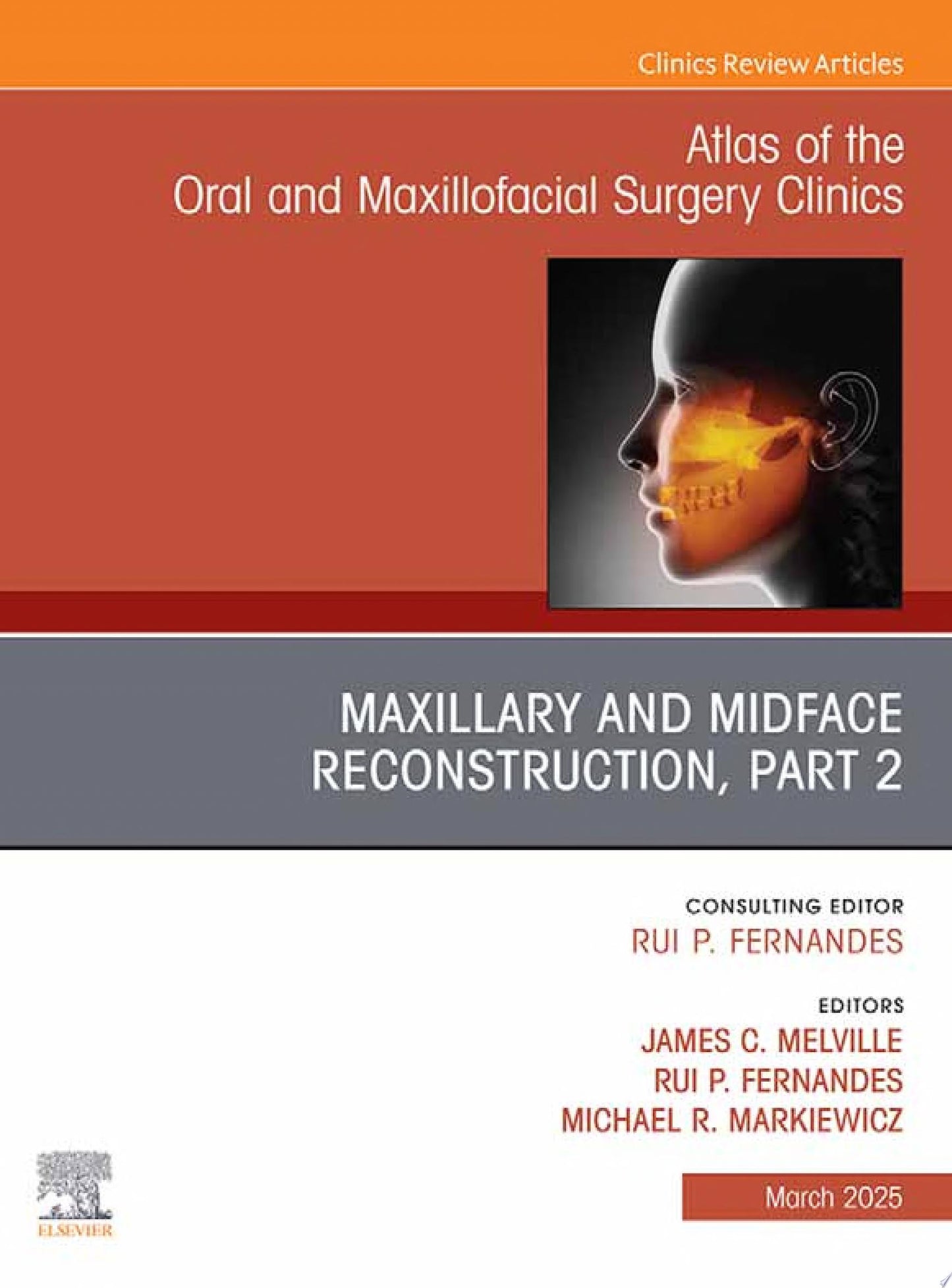 Maxillary and Midface Reconstruction, Part 2, An Issue of Atlas of the Oral & Maxillofacial Surgery Clinics