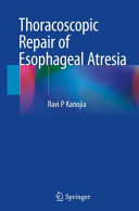 Thoracoscopic Repair of Esophageal Atresia