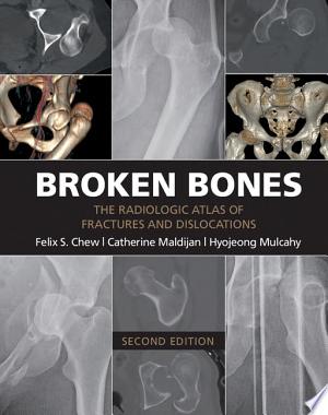 Broken Bones: The X-Ray Atlas of Fractures