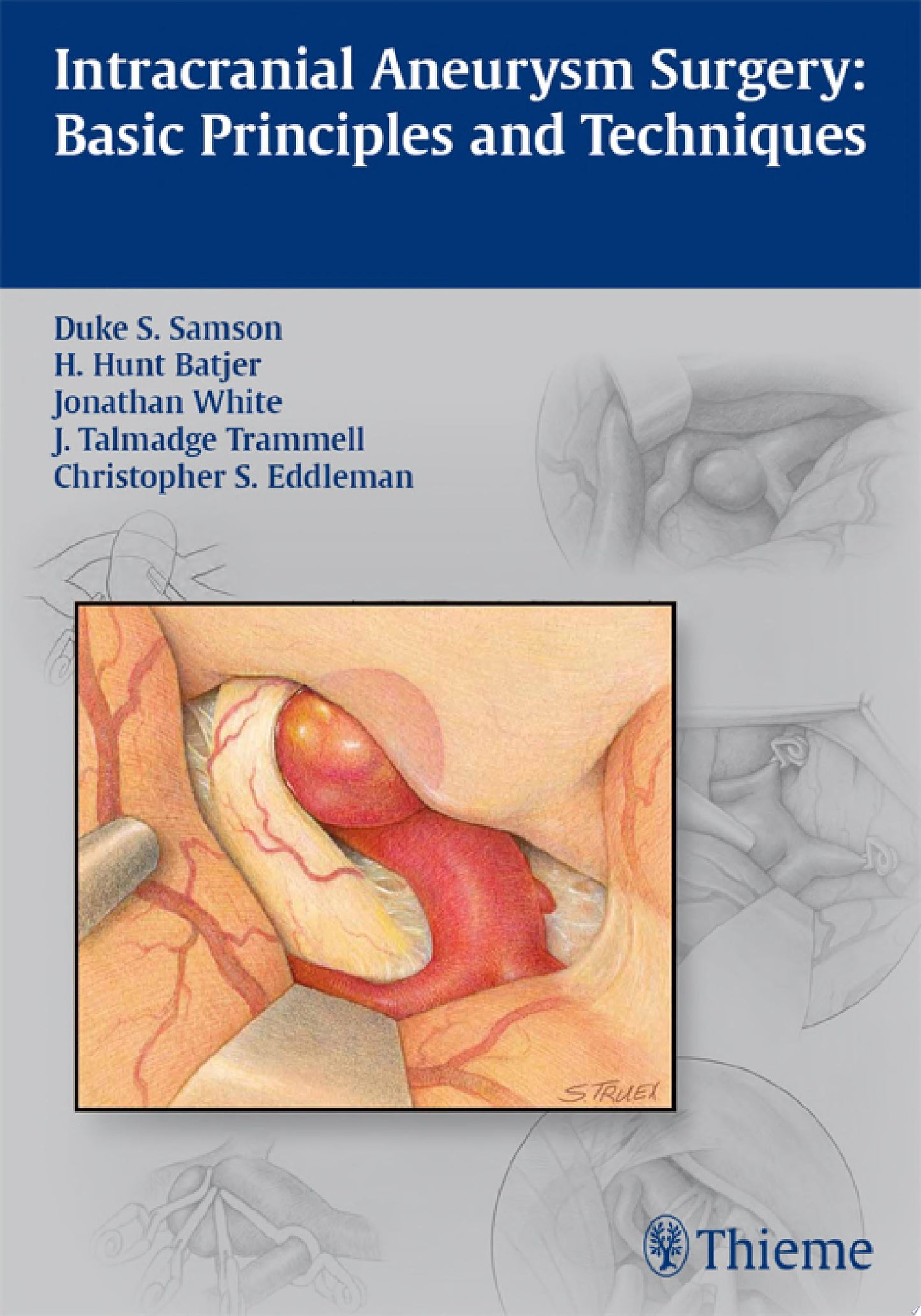 Intracranial Aneurysm Surgery: Basic Principles and Techniques