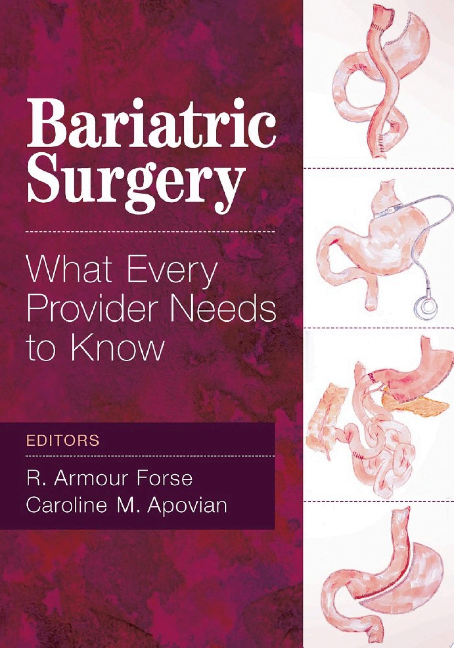 Bariatric Surgery: What Every Provider Needs to Know