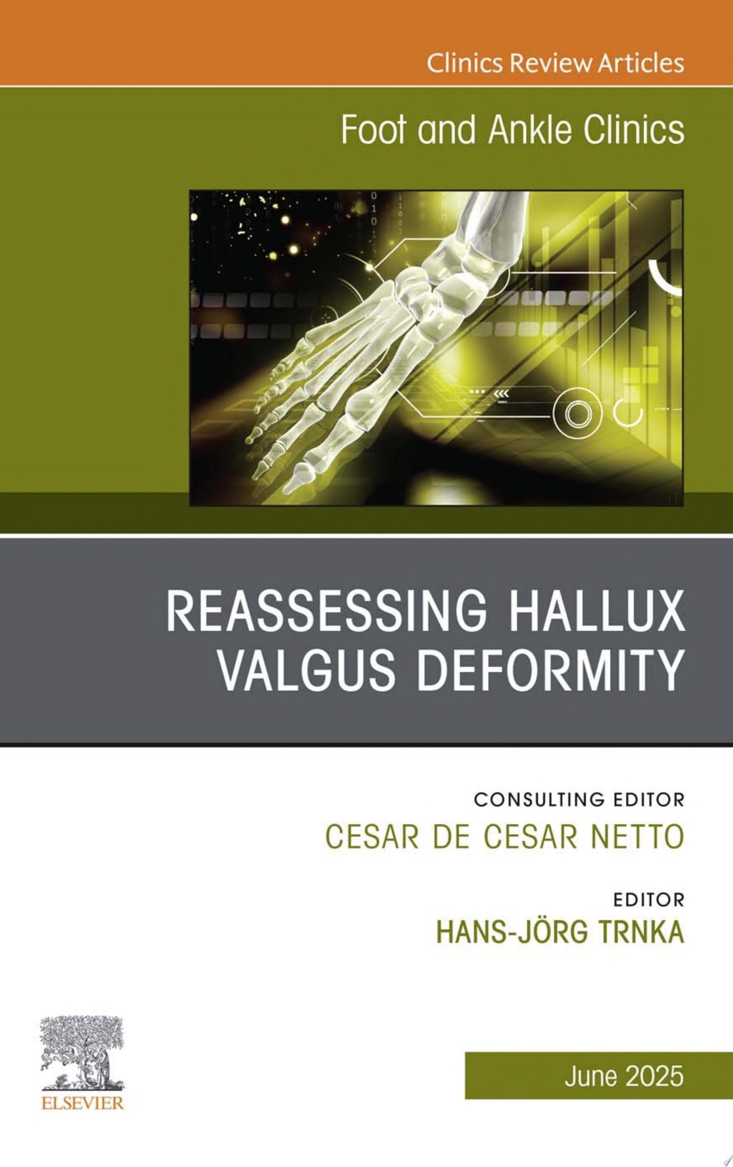 Reassessing Hallux Valgus Deformity, An issue of Foot and Ankle Clinics of North America