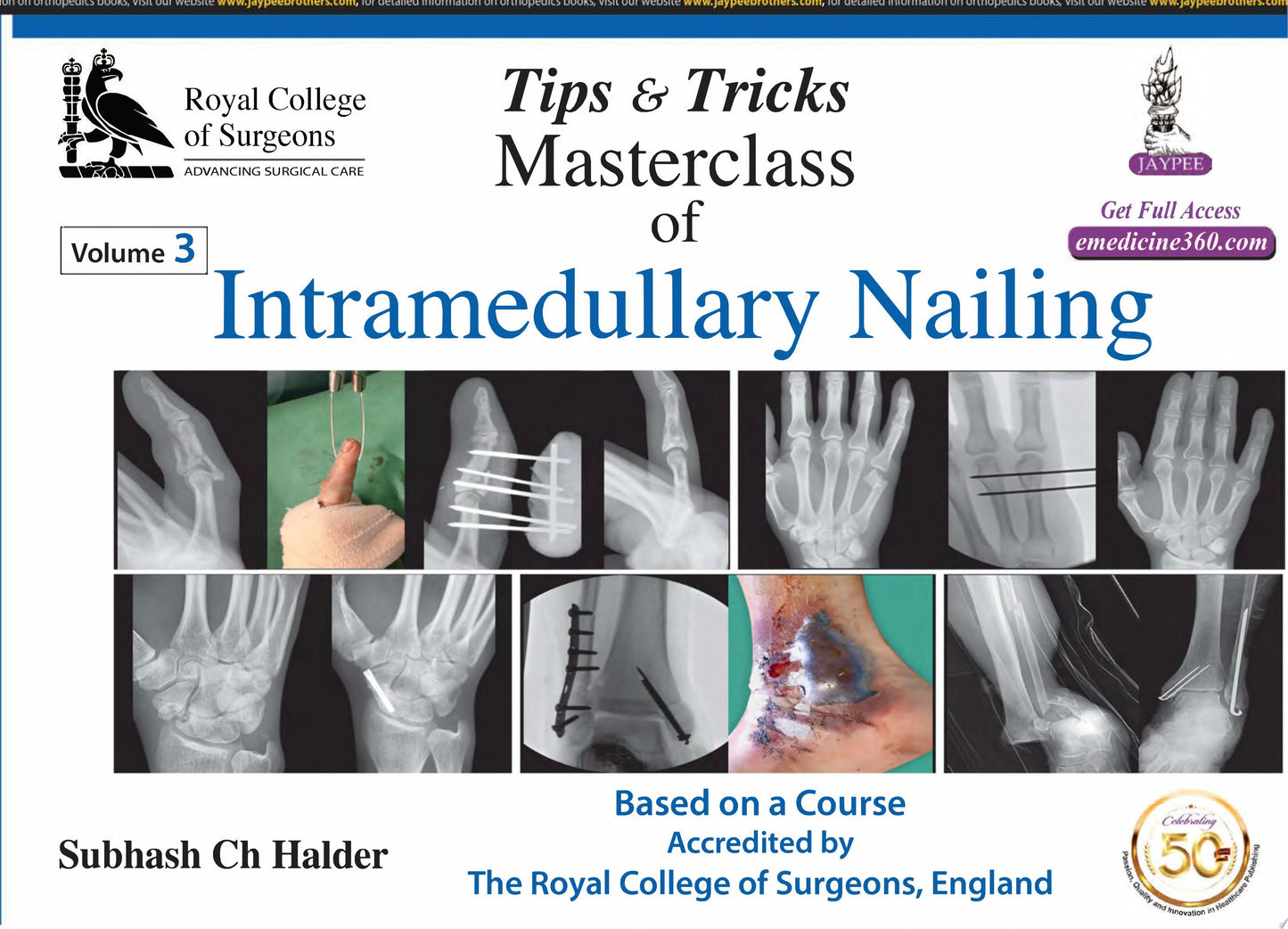 Tips & Tricks Masterclass Of Intramedullary Nailing