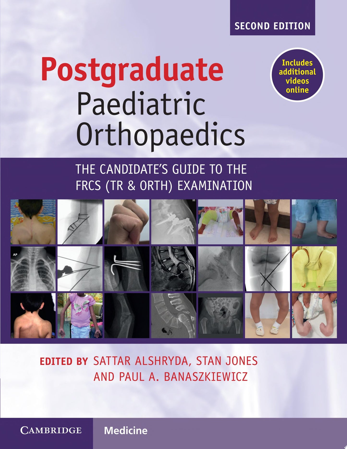 Postgraduate Paediatric Orthopaedics: The Candidate’s Guide to the FRCS Examination