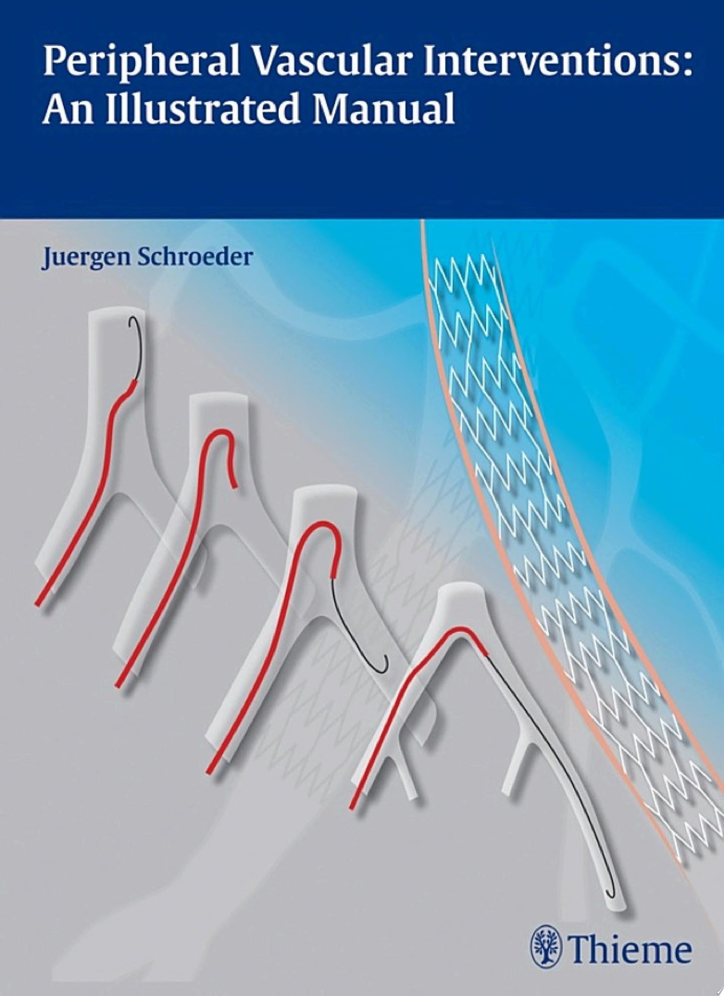 Peripheral Vascular Interventions: An Illustrated Manual