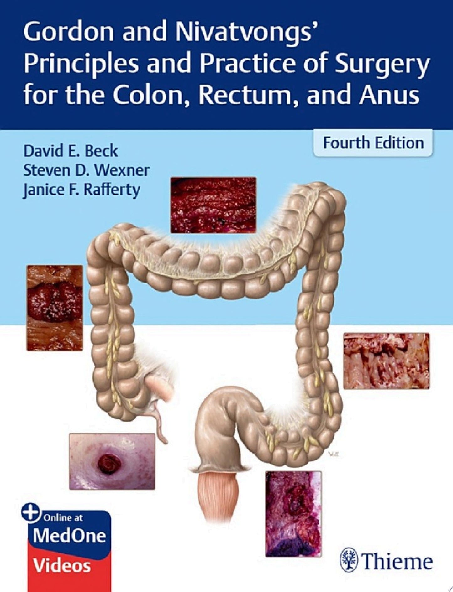 Gordon and Nivatvongs’ Principles and Practice of Surgery for the Colon, Rectum, and Anus, 4th Edition