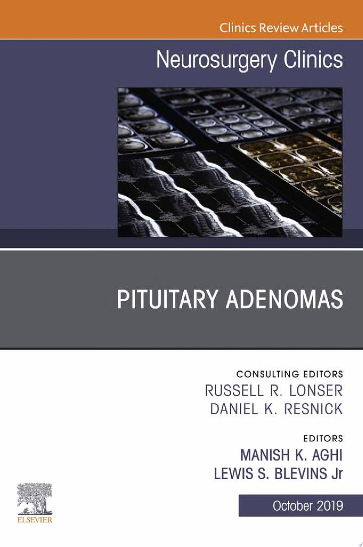 Pituitary Adenoma, An Issue of Neurosurgery Clinics of North America