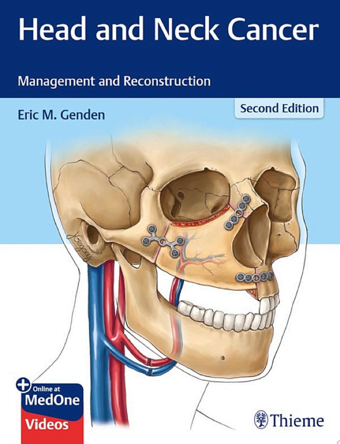 Head and Neck Cancer: Management and Reconstruction, 2nd Edition