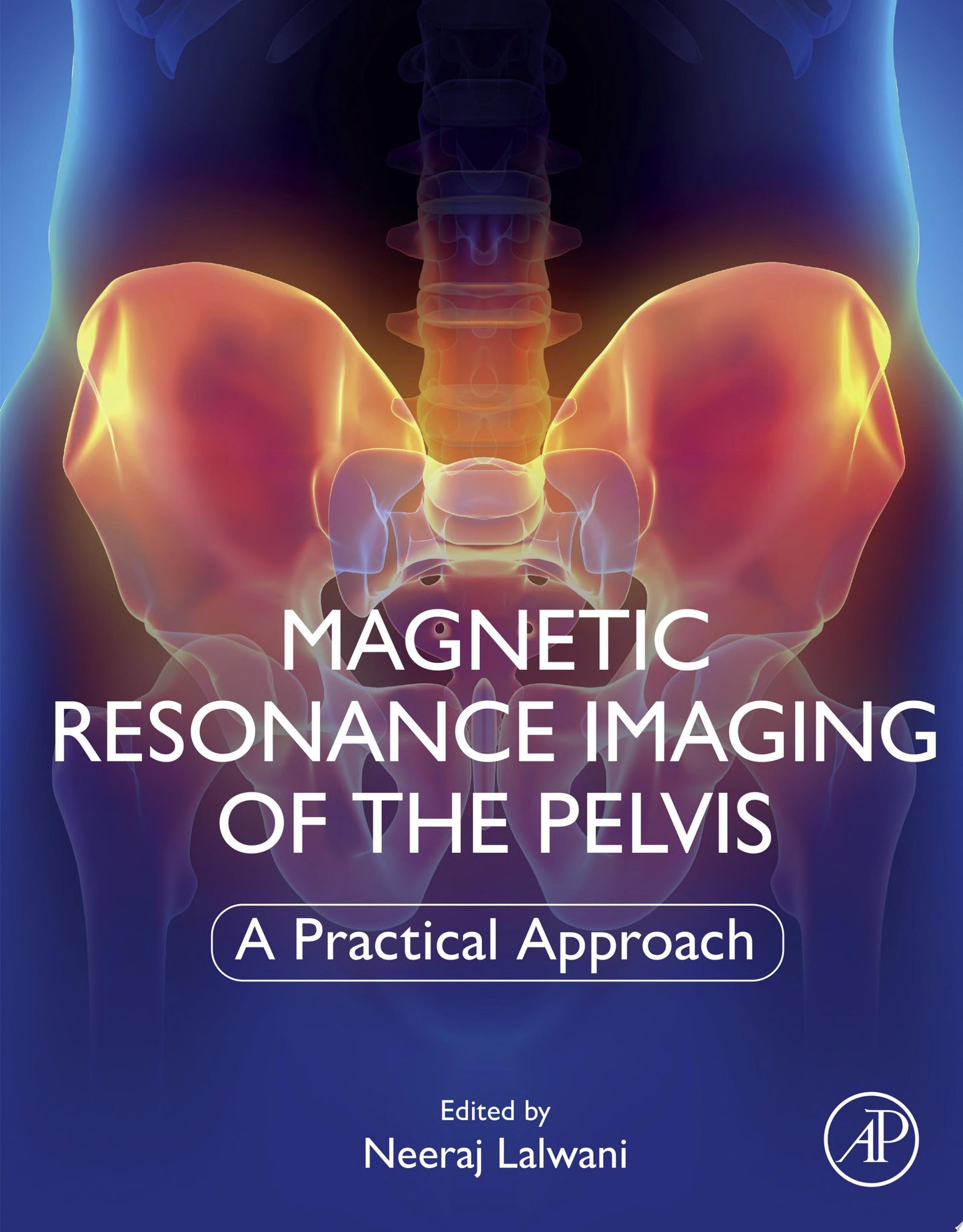 Magnetic Resonance Imaging of The Pelvis: A Practical Approach