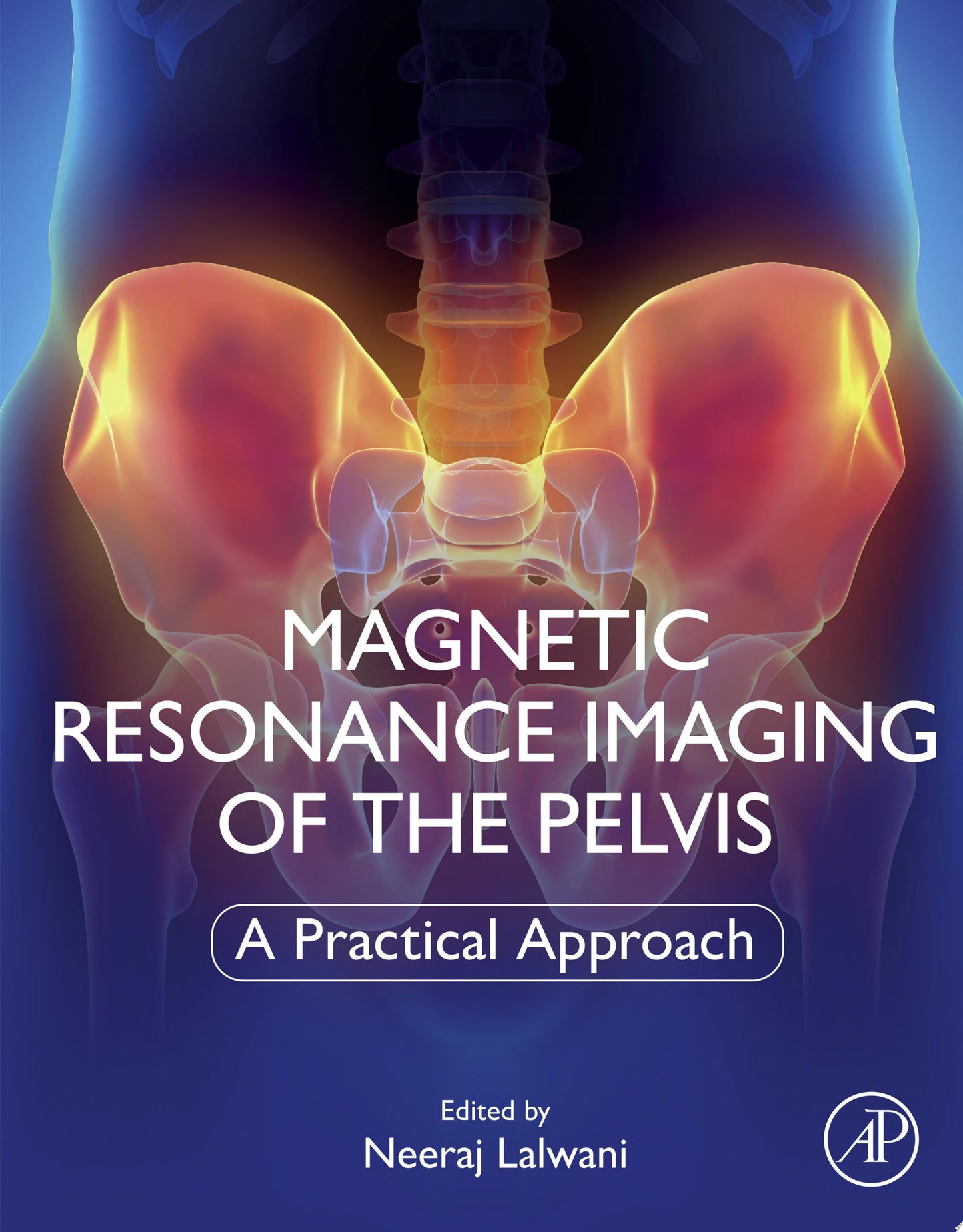 Magnetic Resonance Imaging of The Pelvis: A Practical Approach