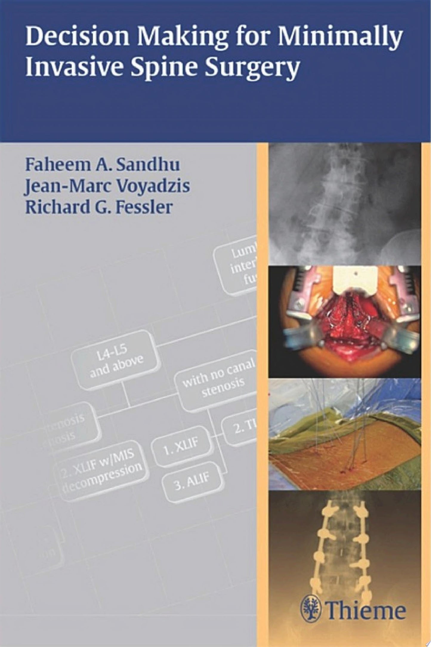 Decision Making for Minimally Invasive Spine Surgery