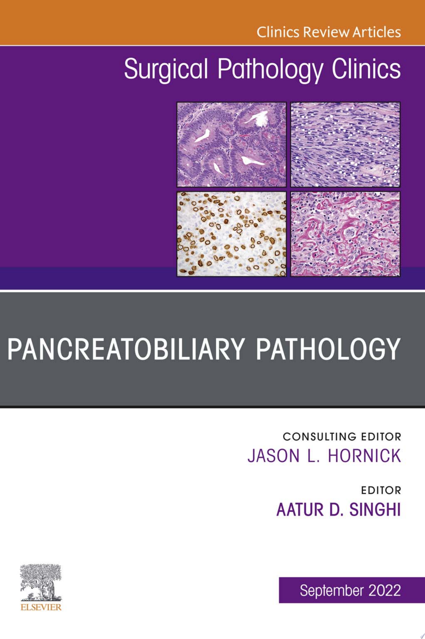 Pancreatobiliary Pathology, An Issue of Surgical Pathology Clinics, E-Book