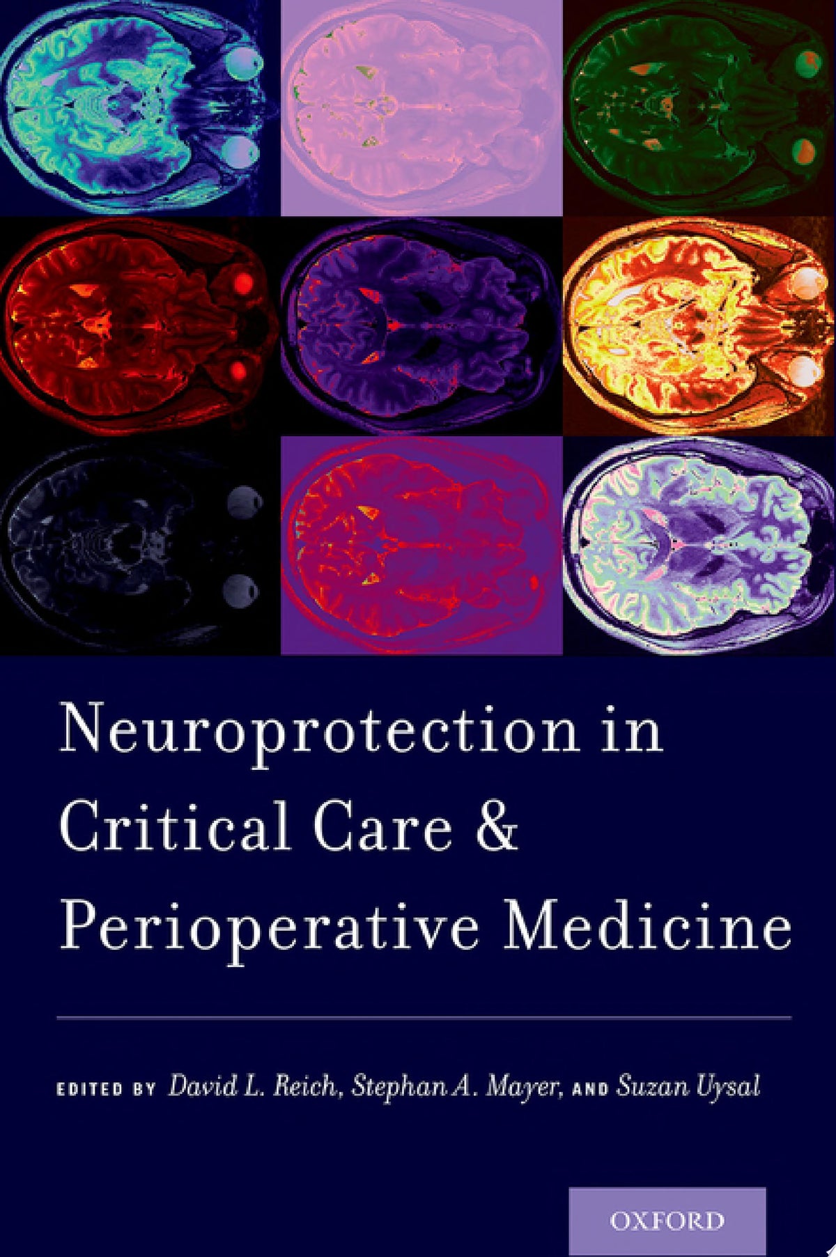 Neuroprotection in Critical Care and Perioperative Medicine