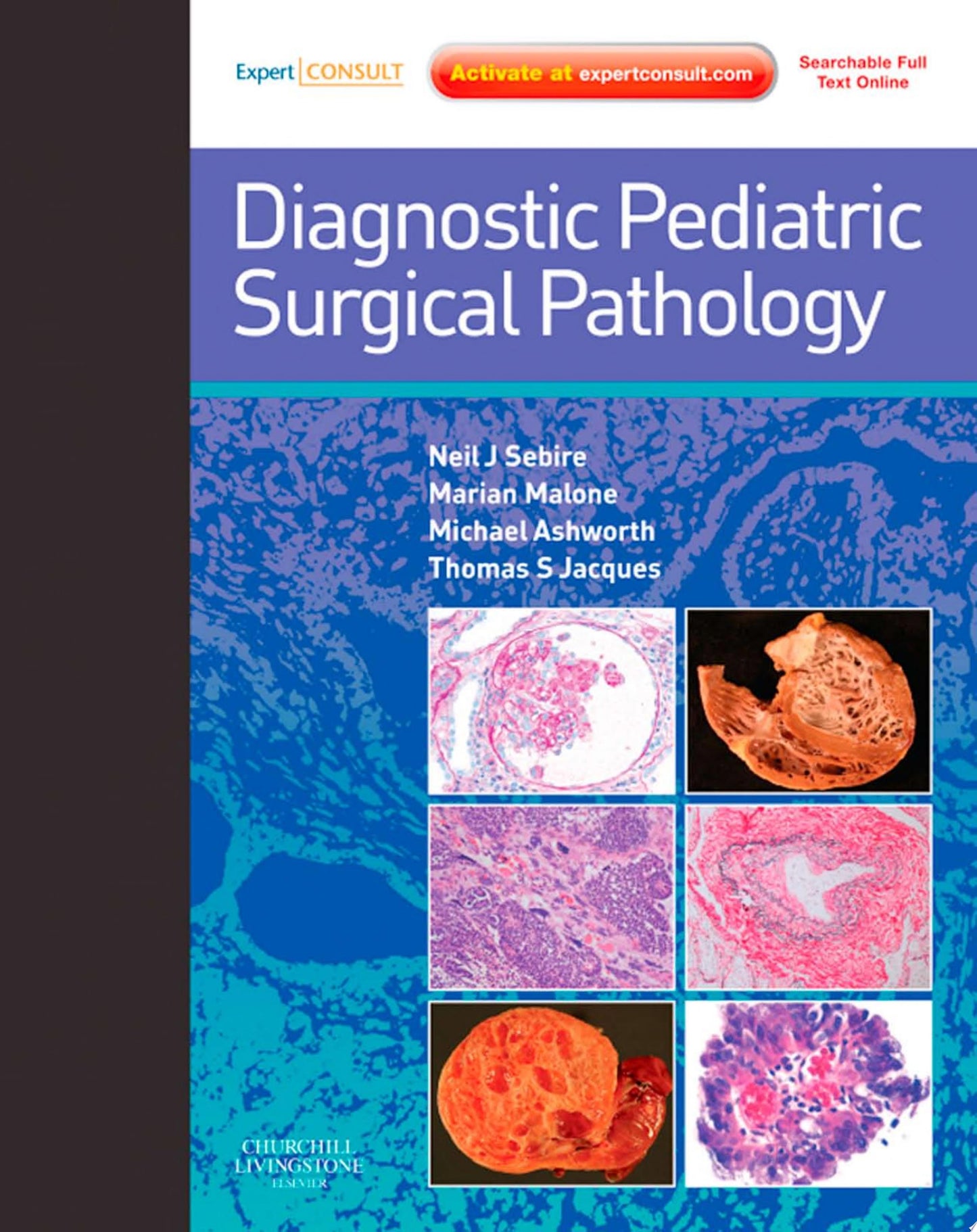 Diagnostic Pediatric Surgical Pathology: Expert Consult – Online and Print