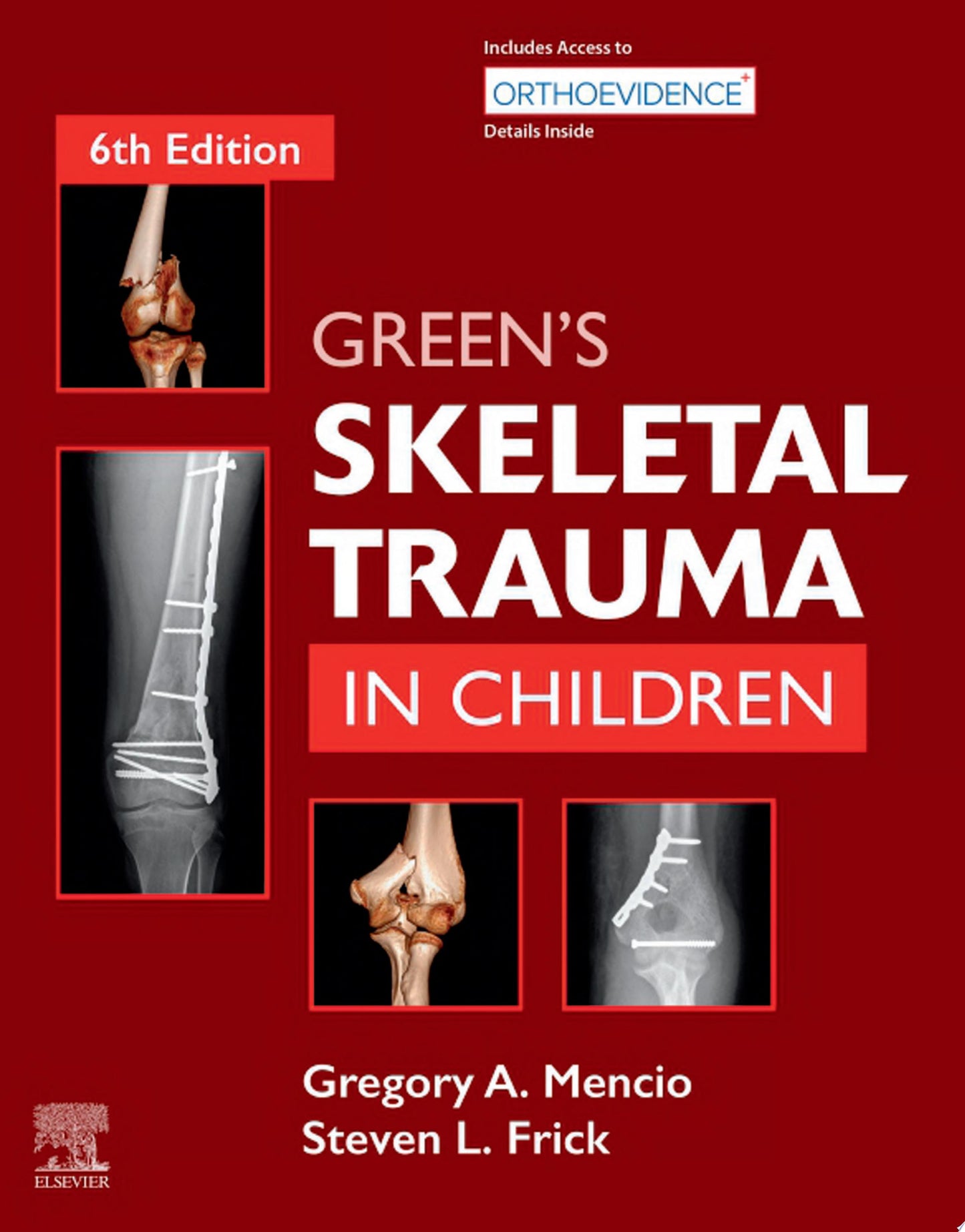 Green’s Skeletal Trauma in Children, 5th Edition