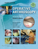 Operative Arthroscopy, 4th Edition