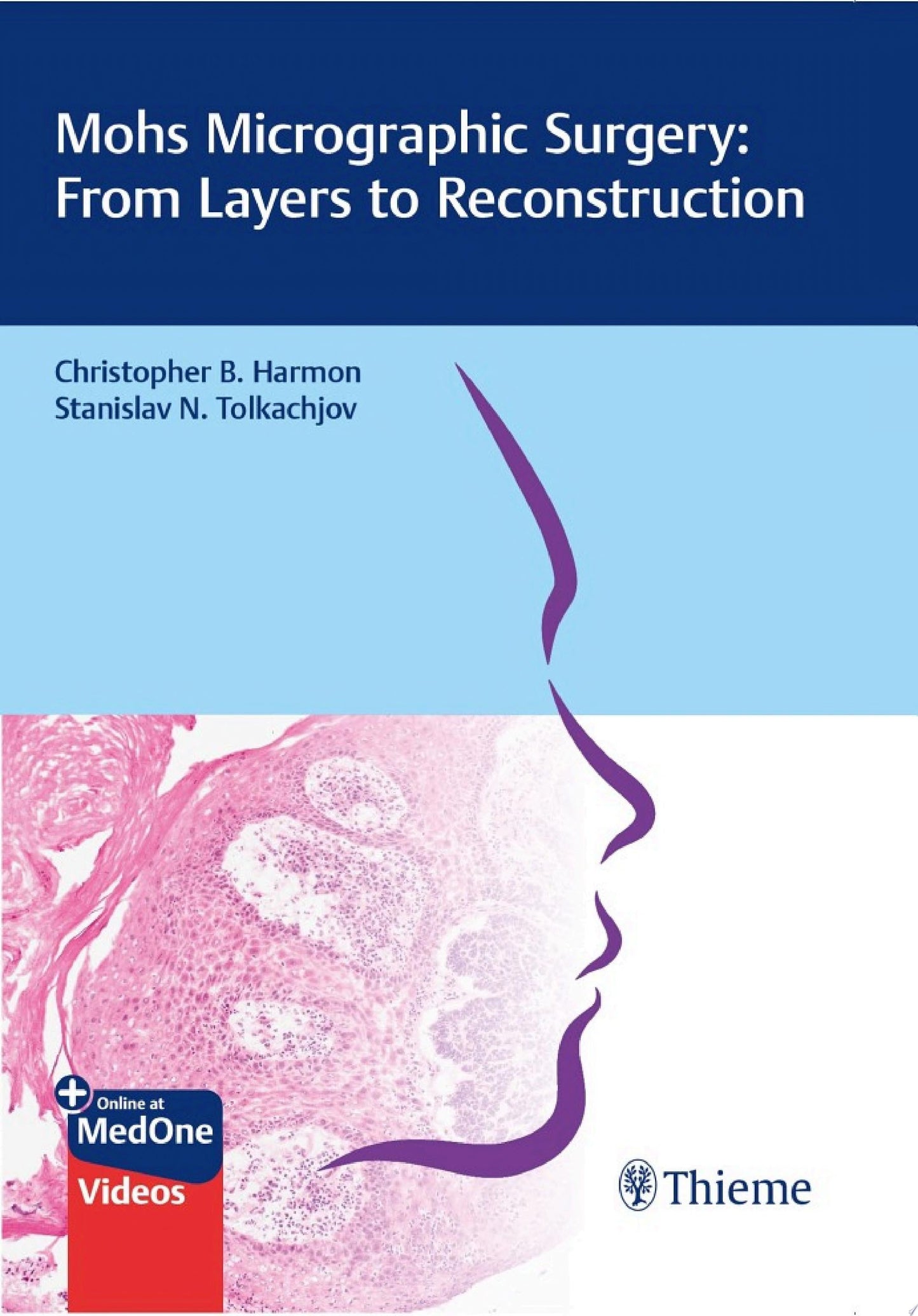Mohs Micrographic Surgery: From Layers to Reconstruction