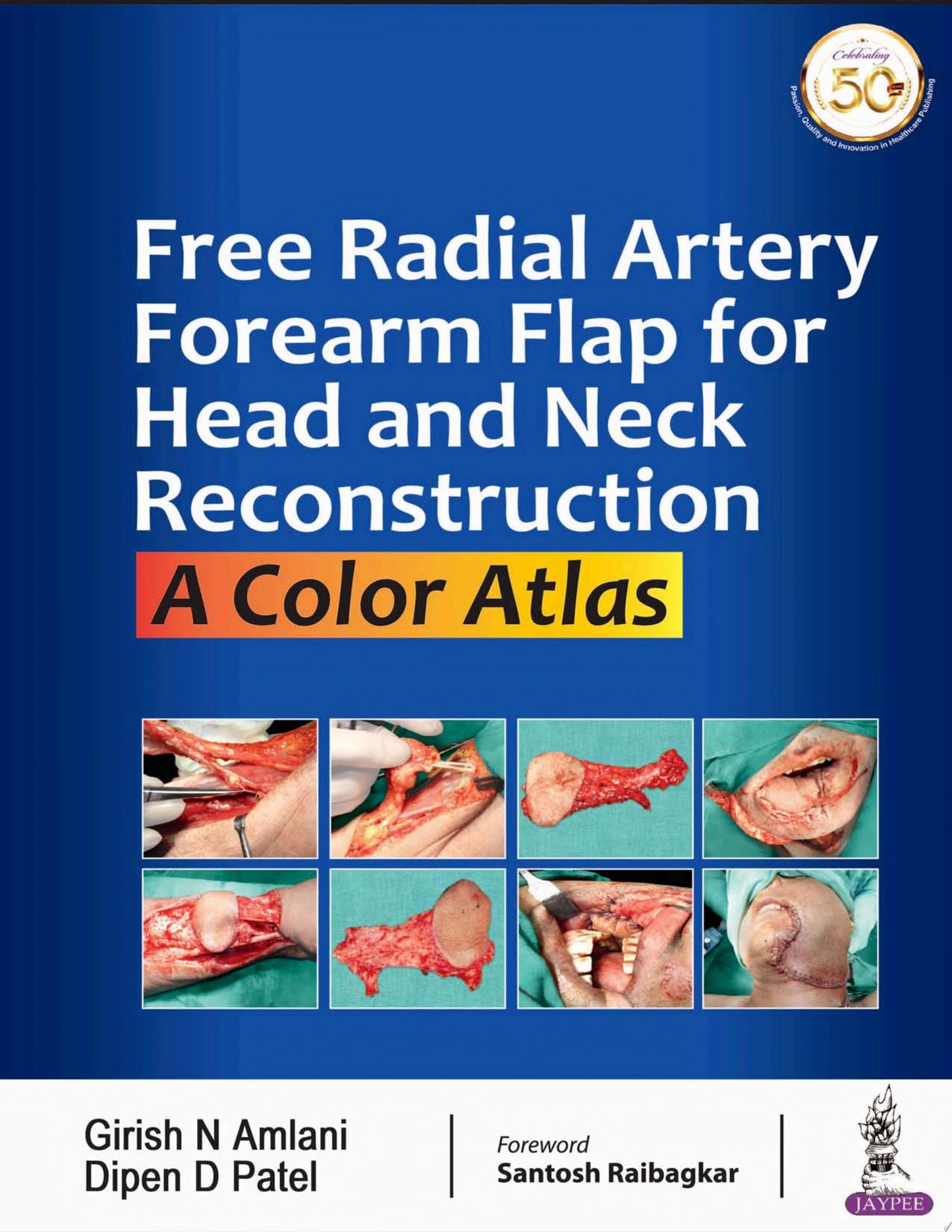 Free Radial Artery Forearm Flap For Head And Neck Reconstruction: A Color Atlas
