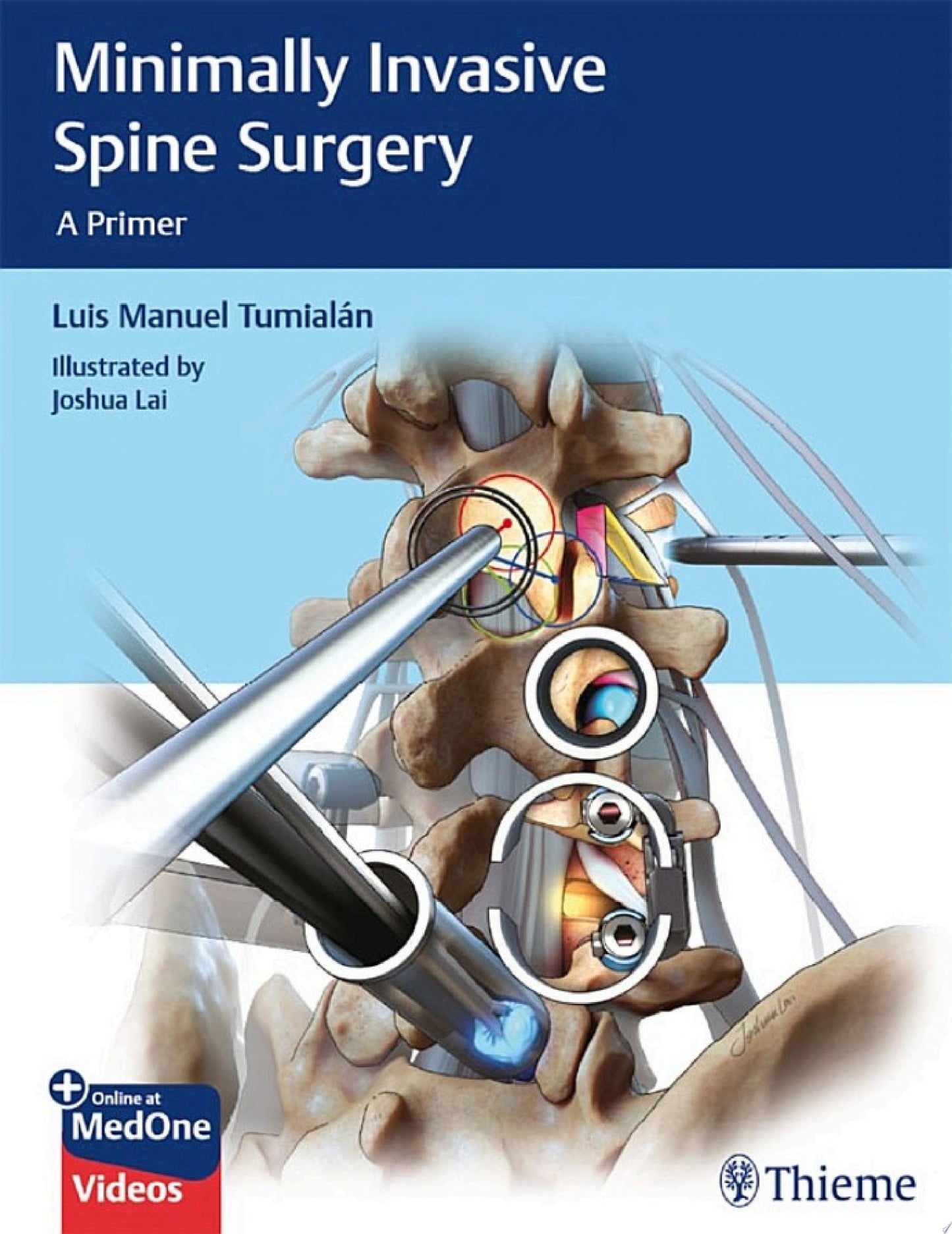 Minimally Invasive Spine Surgery: A Primer