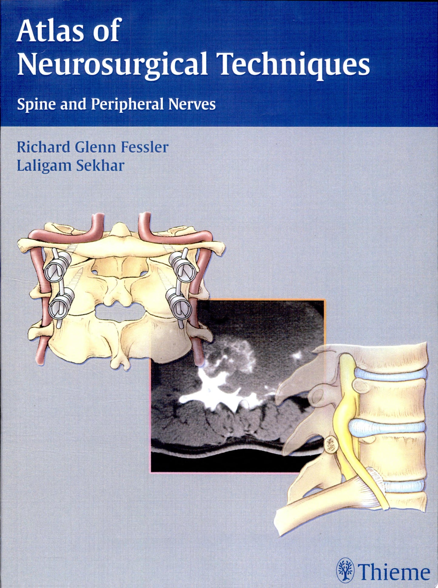 Atlas of Neurosurgical Techniques: Spine and Peripheral Nerves