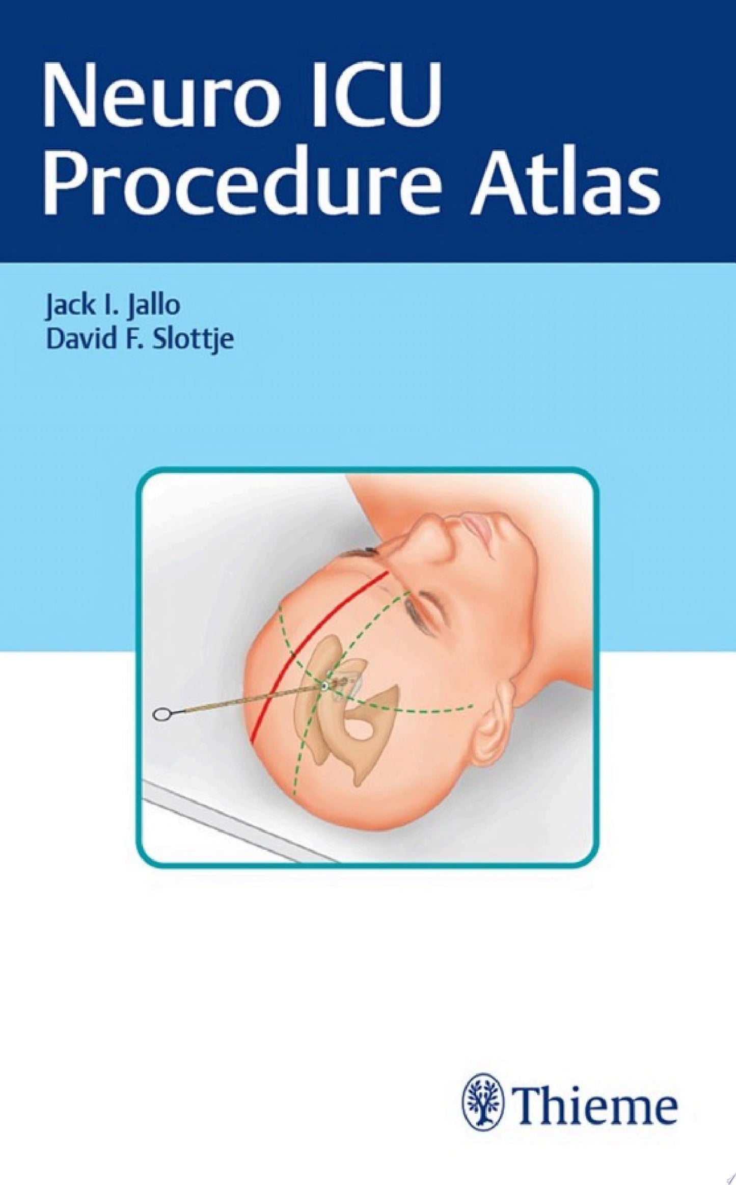 Neuro ICU Procedure Atlas