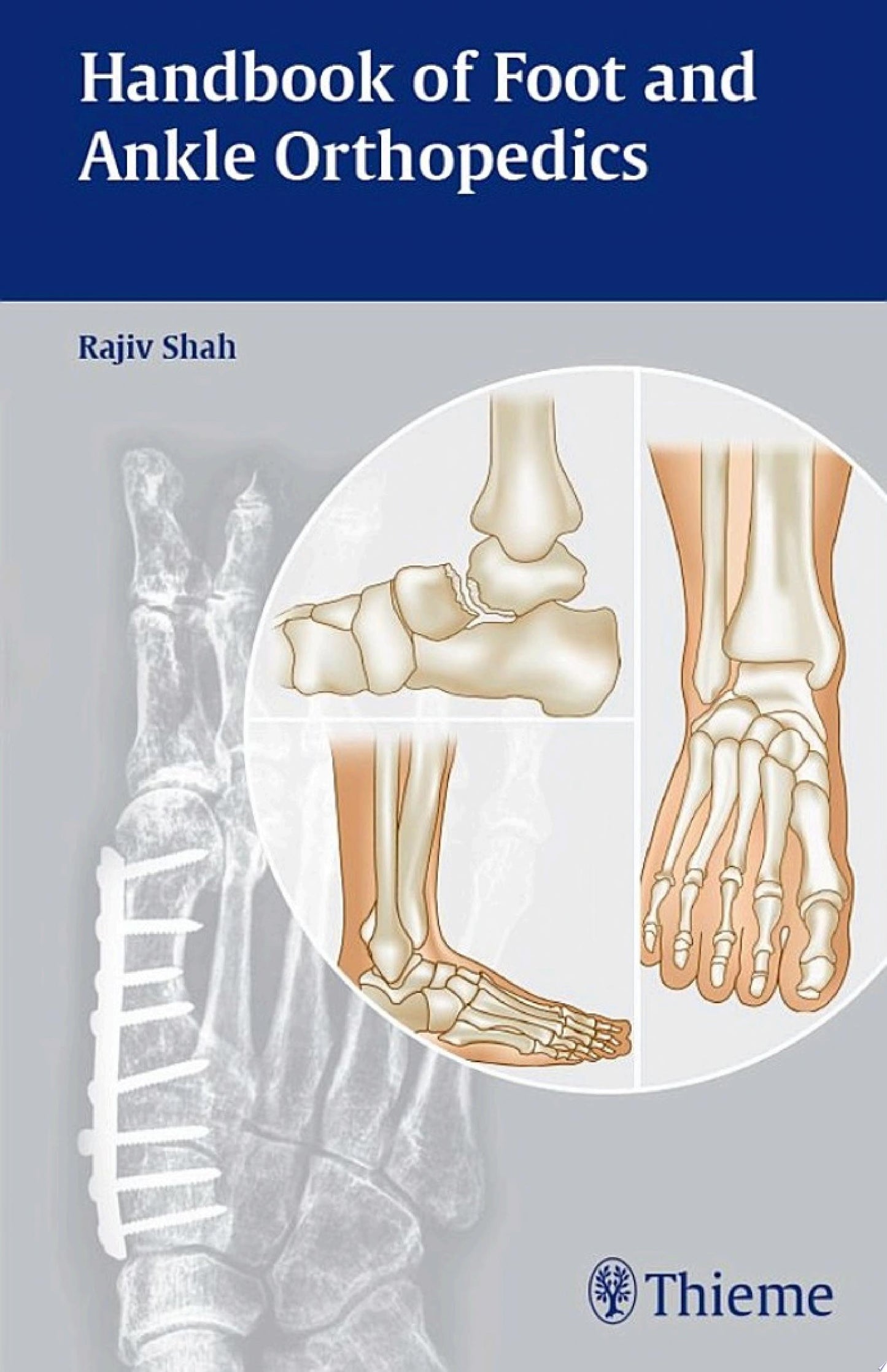 Handbook of Foot and Ankle Orthopedics