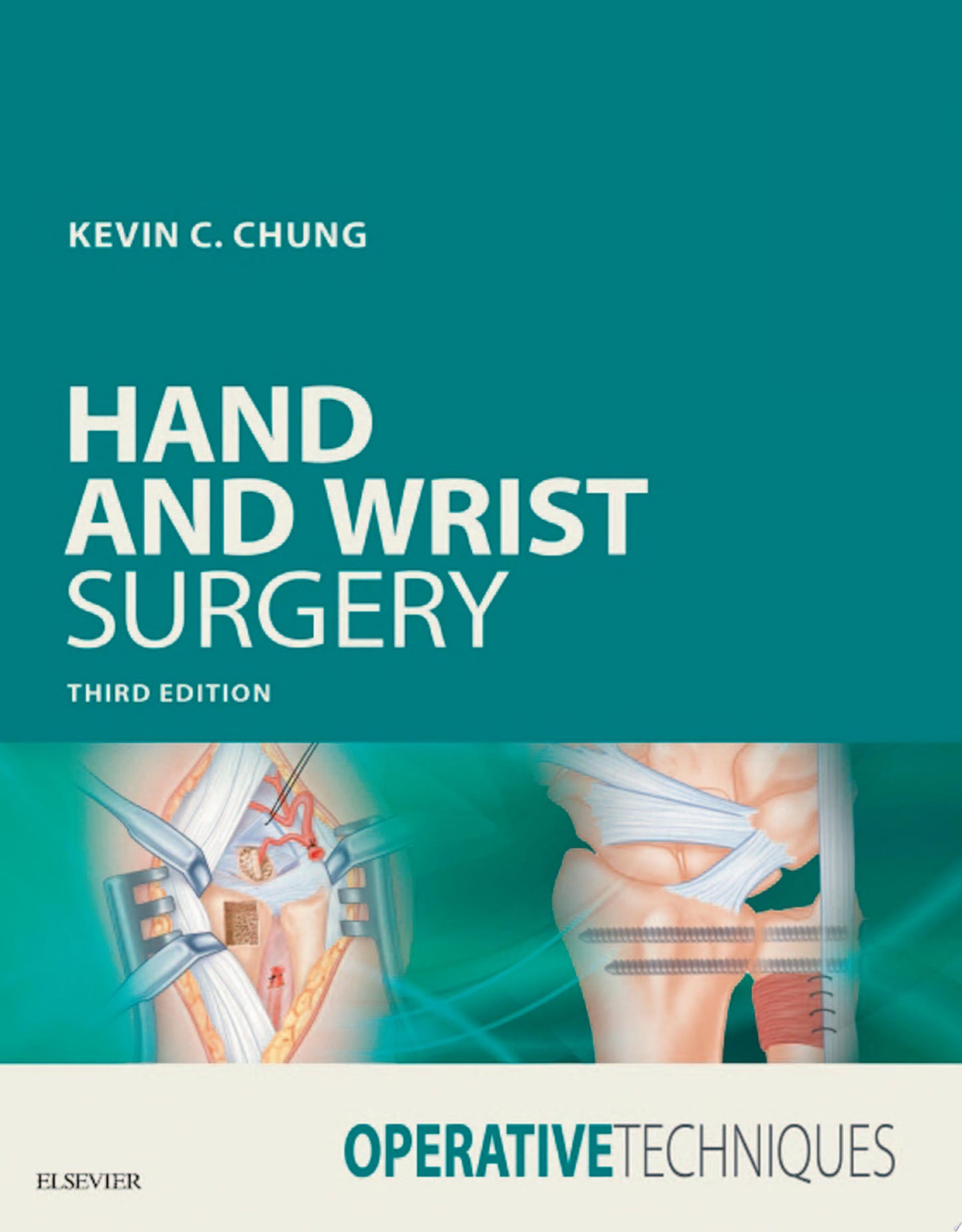 Operative Techniques: Hand and Wrist Surgery, 2nd Edition