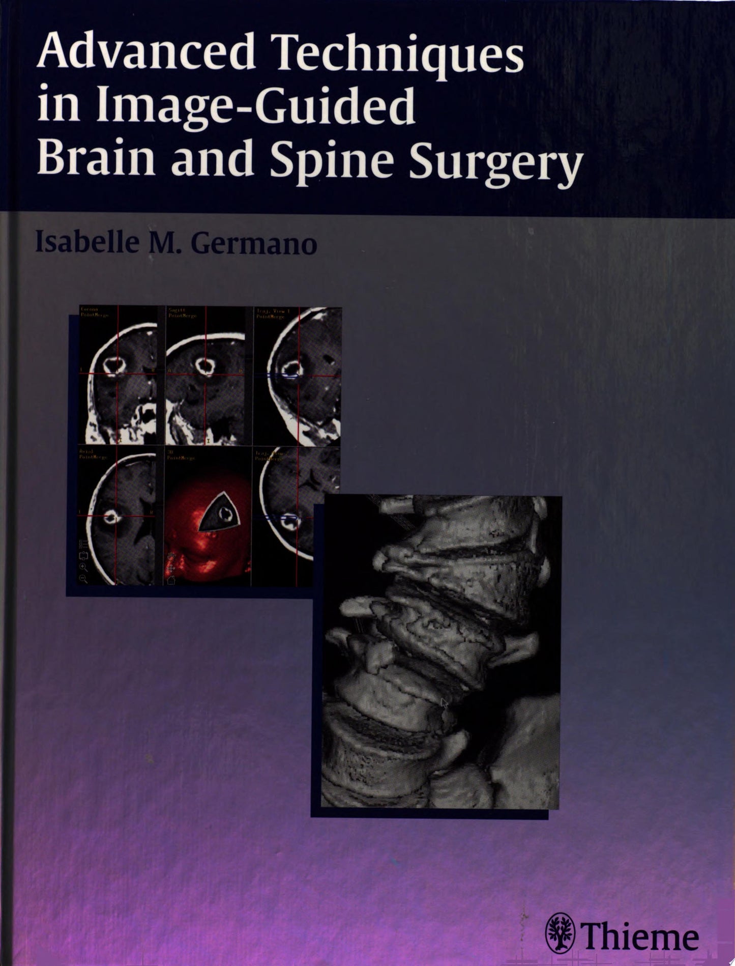 Advanced Techniques in Image-Guided Brain and Spine Surgery