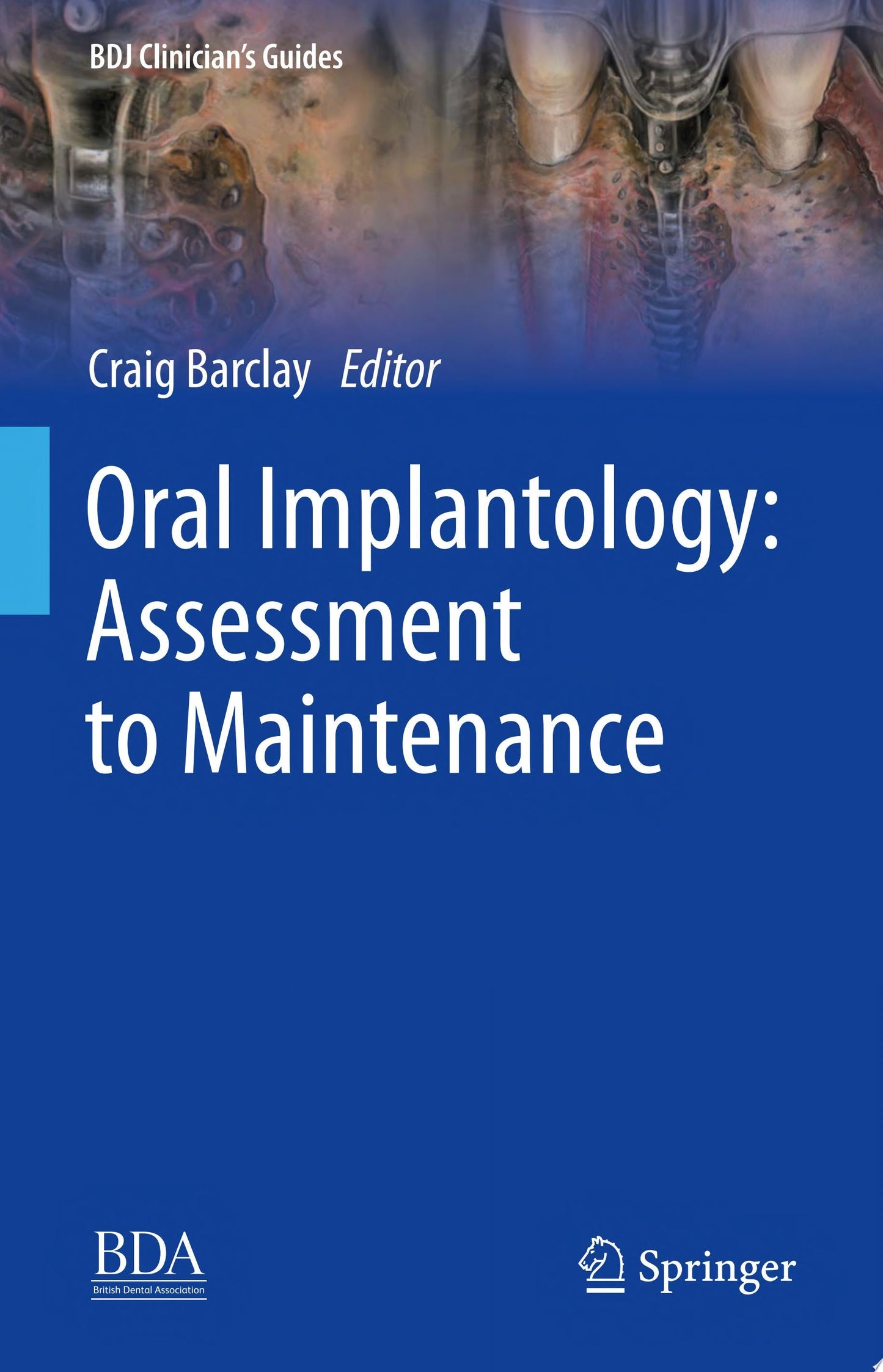 Oral Implantology: Assessment to Maintenance