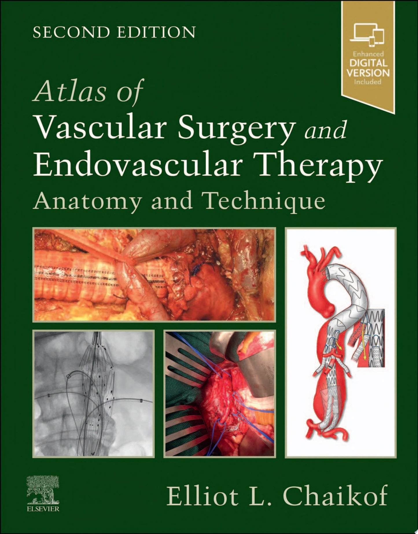 Atlas of Vascular Surgery and Endovascular Therapy: Anatomy and Technique, 2nd edition