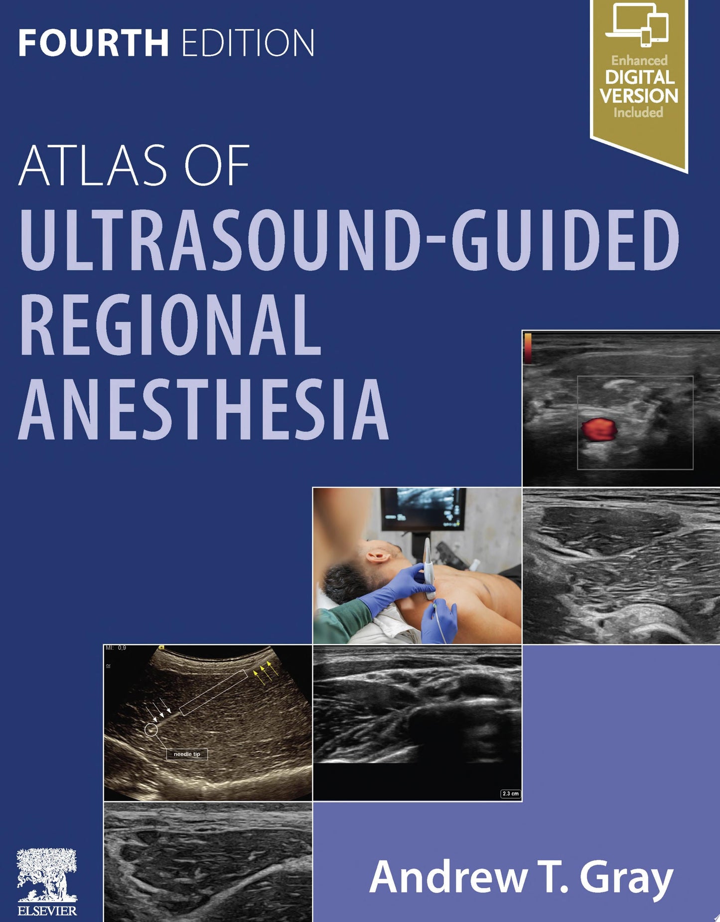 Atlas of Ultrasound-Guided Regional Anesthesia, 4th edition