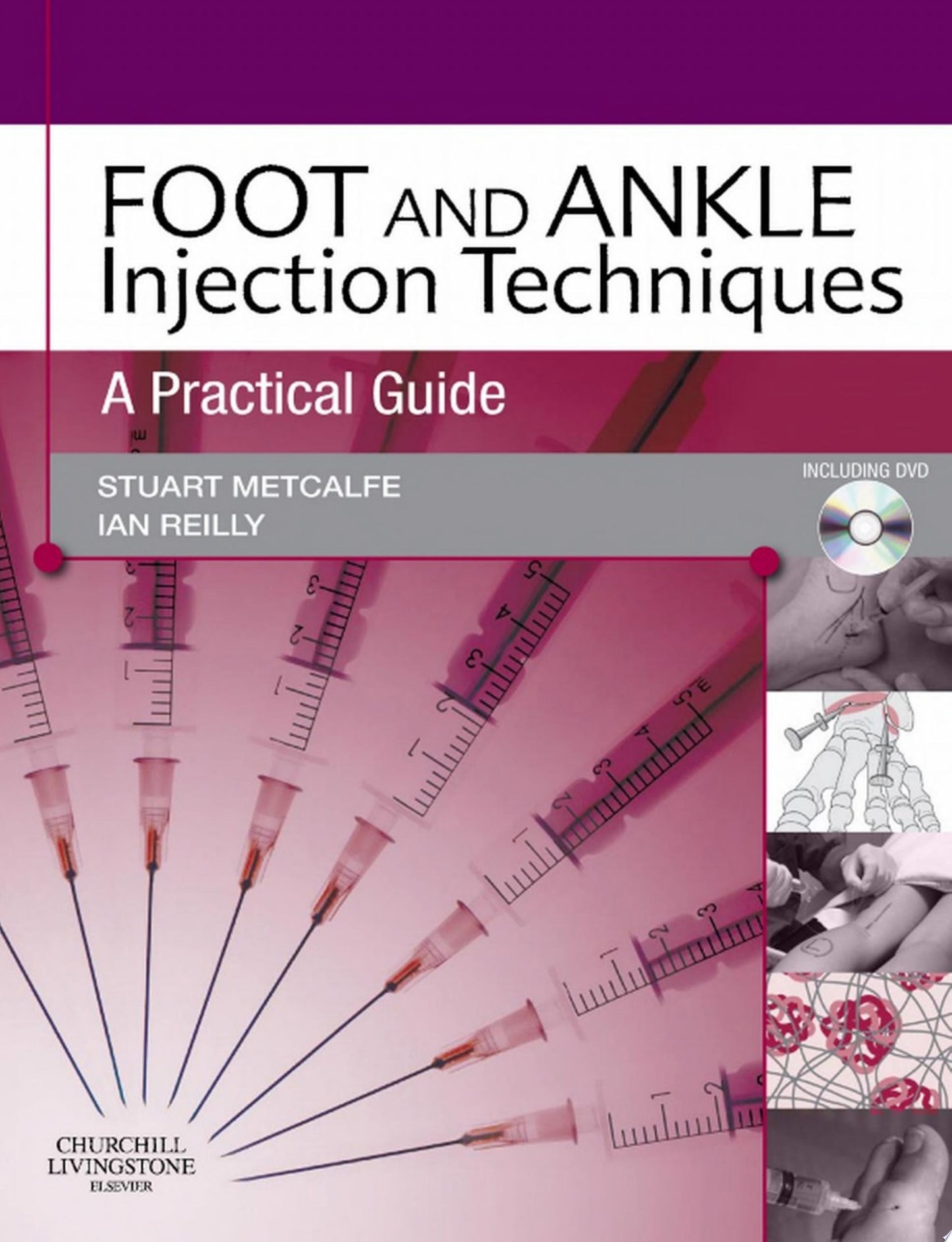 Foot and Ankle Injection Techniques: A Practical Guide 1st Edition