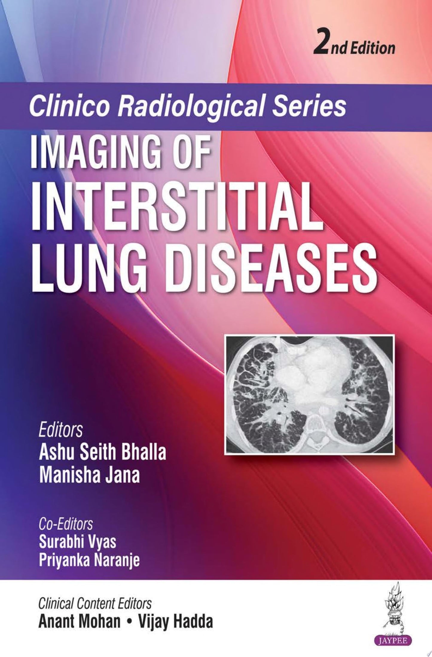 Clinico Radiological Series: Imaging of Interstitial Lung Diseases, 2nd edition