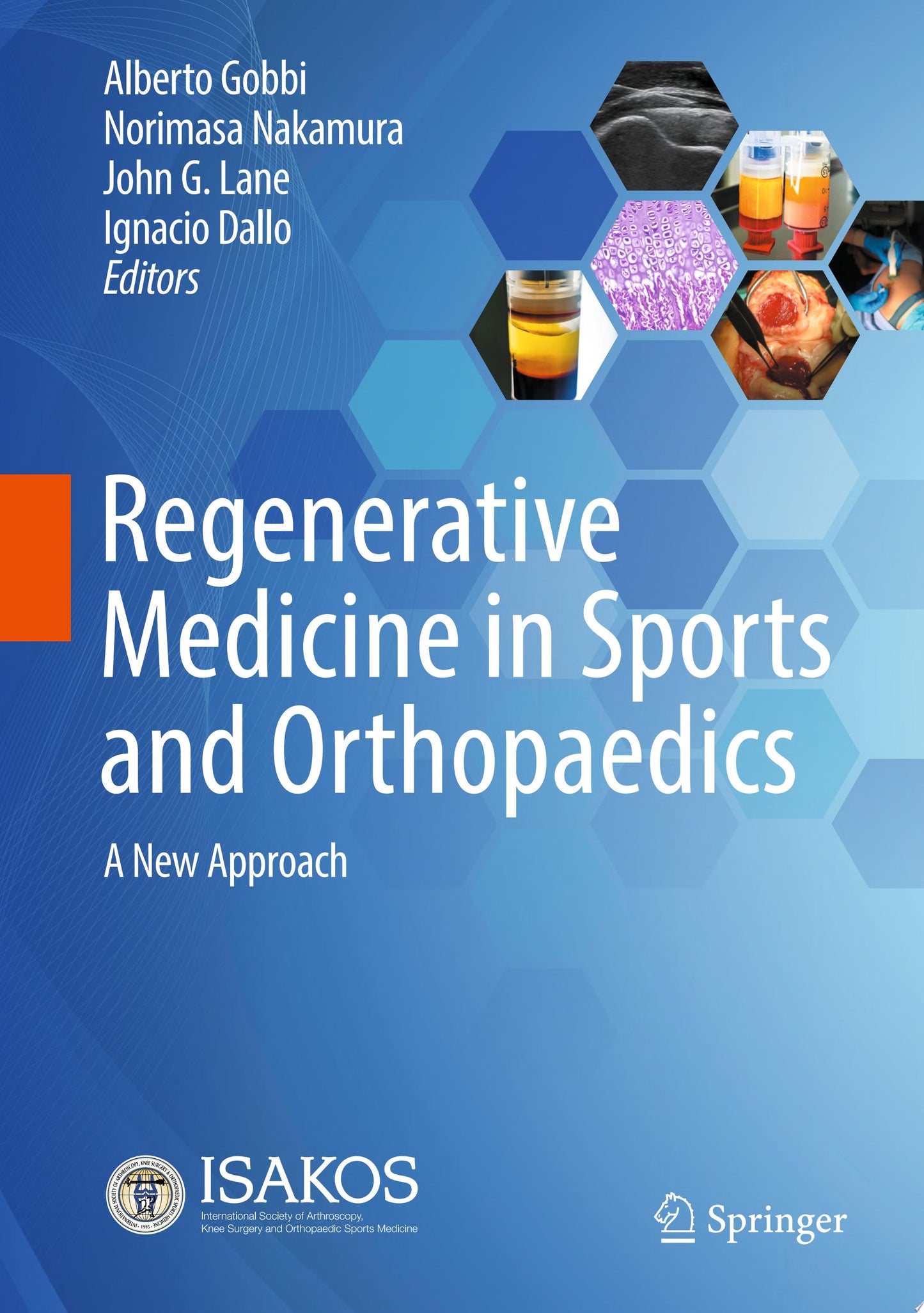 Regenerative Medicine in Sports and Orthopaedics: A New Approach