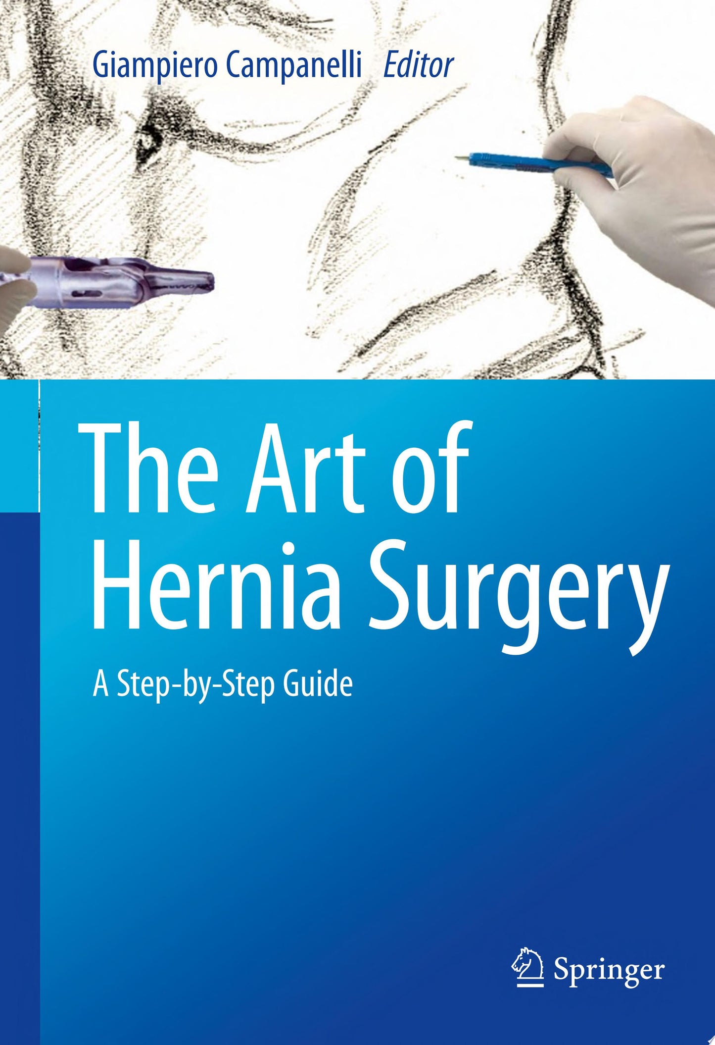 Hernia Surgery
