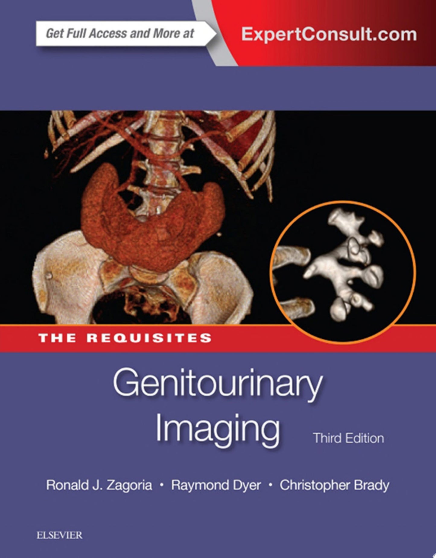 Genitourinary Imaging