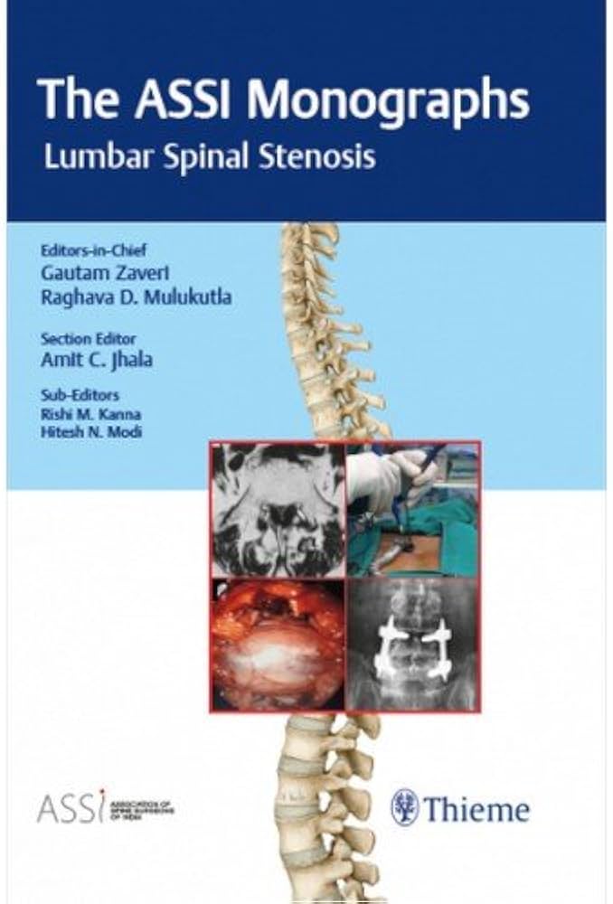 The ASSI Monographs: Lumbar Spinal Stenosis