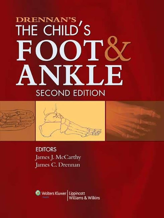 Drennan’s The Child’s Foot and Ankle, 2nd Edition