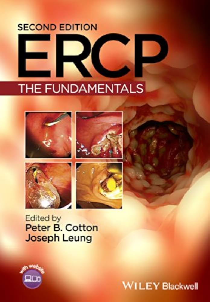 ERCP: The Fundamentals, 2e