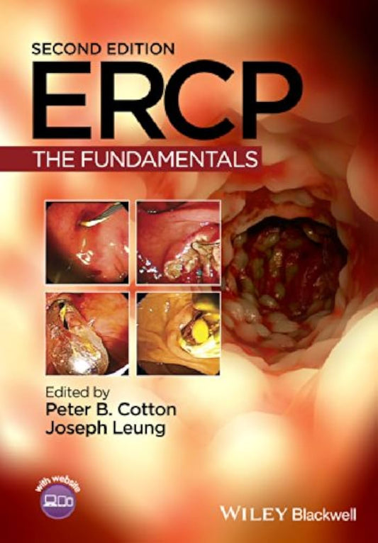 ERCP: The Fundamentals, 2e