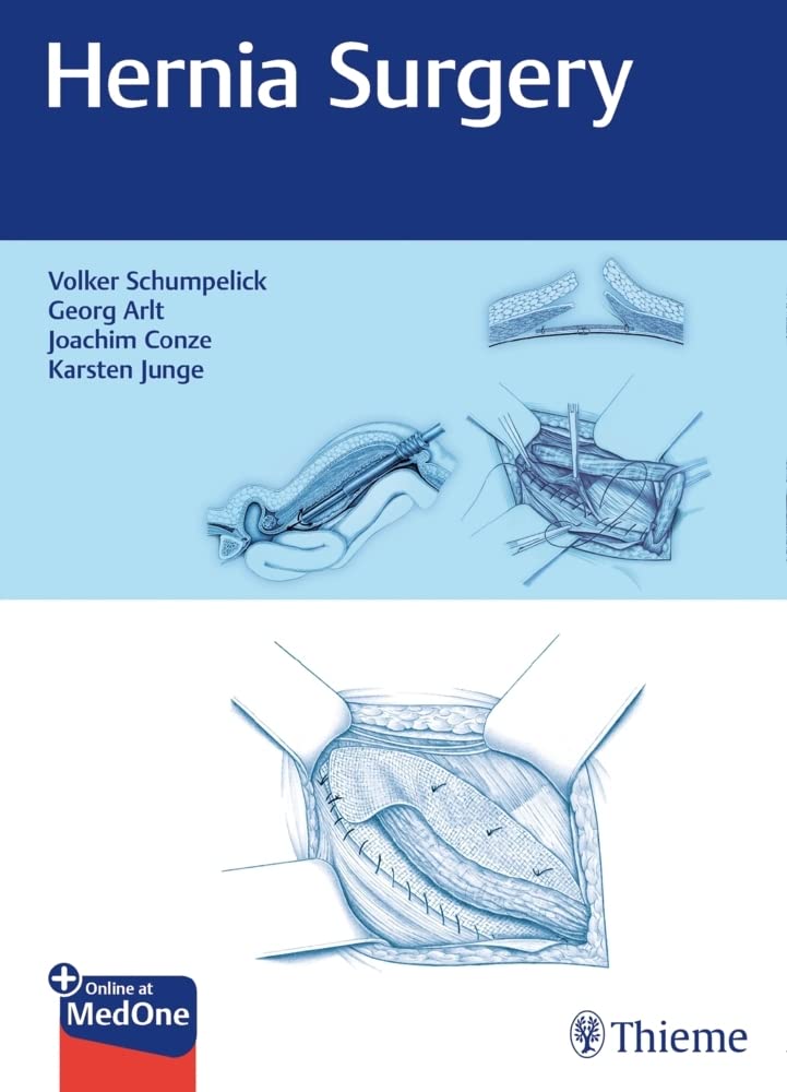 Hernia Surgery 1st Edition