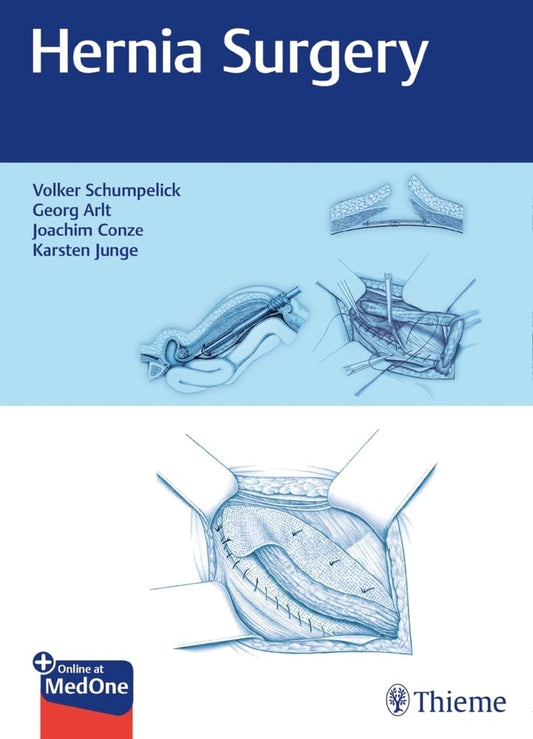 Hernia Surgery 1st Edition