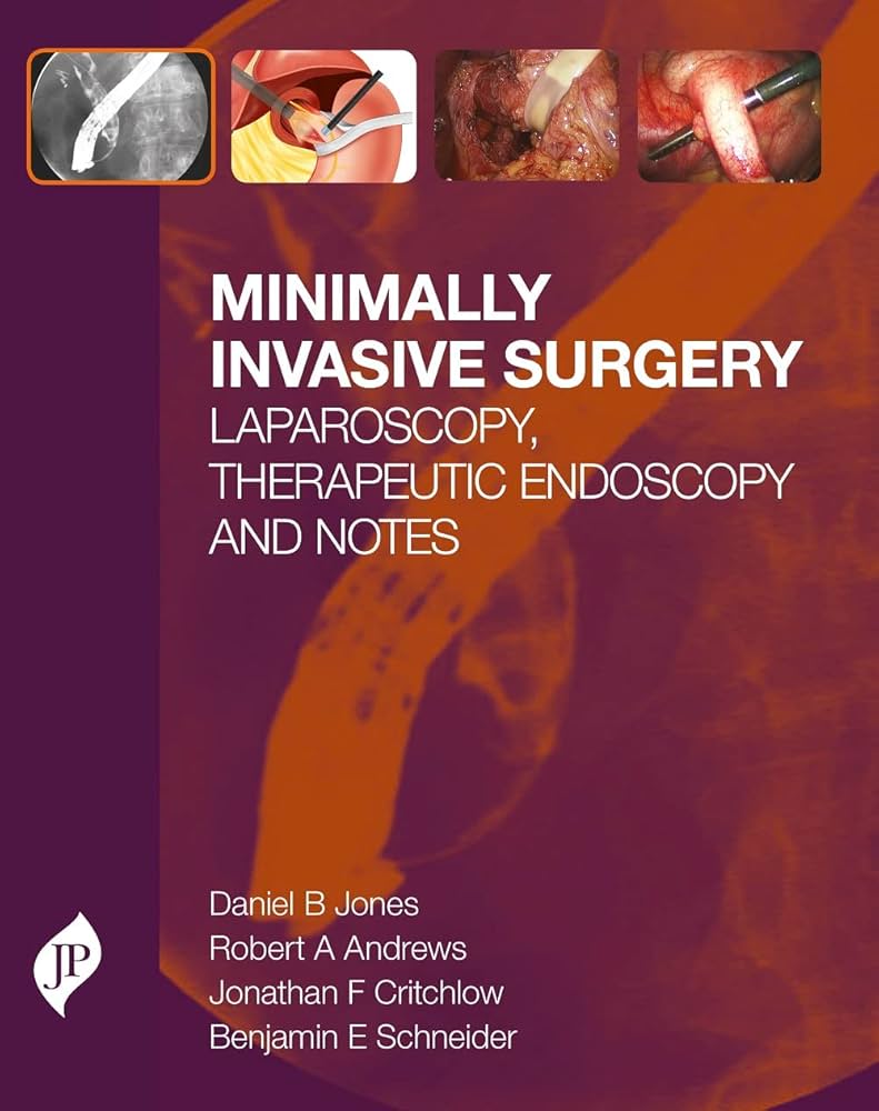Minimally Invasive Surgery: Laparoscopy, Therapeutic Endoscopy and Notes