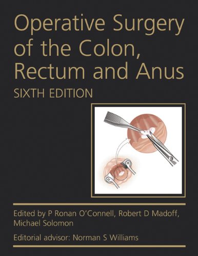 Operative Surgery of the Colon, Rectum and Anus, 6th Edition