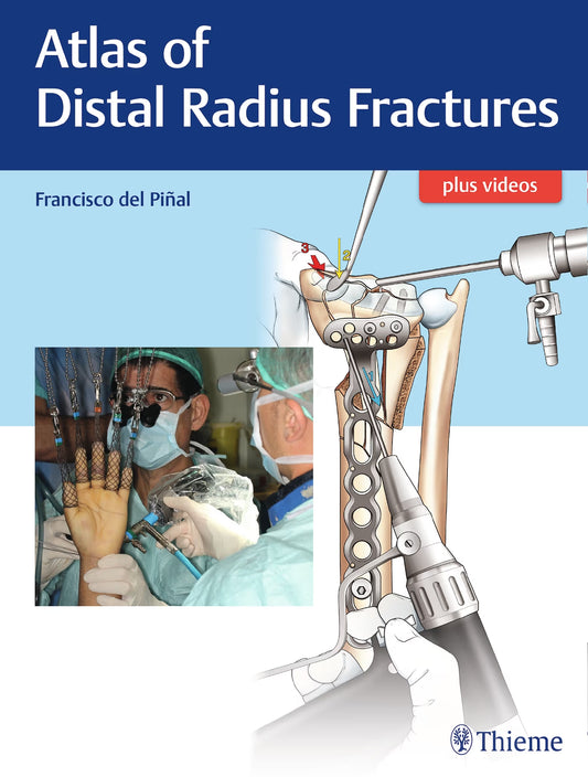 Atlas of Distal Radius Fractures, 1st edition