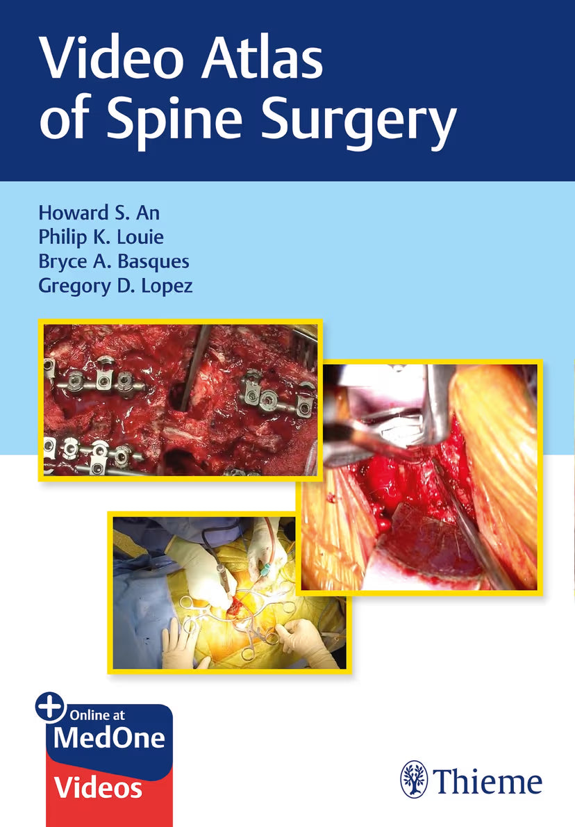Video Atlas of Spine Surgery (PDF + VIDEOS)