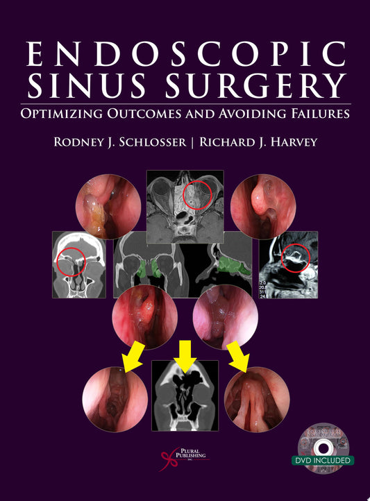 Endoscopic Sinus Surgery: Optimizing Outcomes and Avoiding Failures