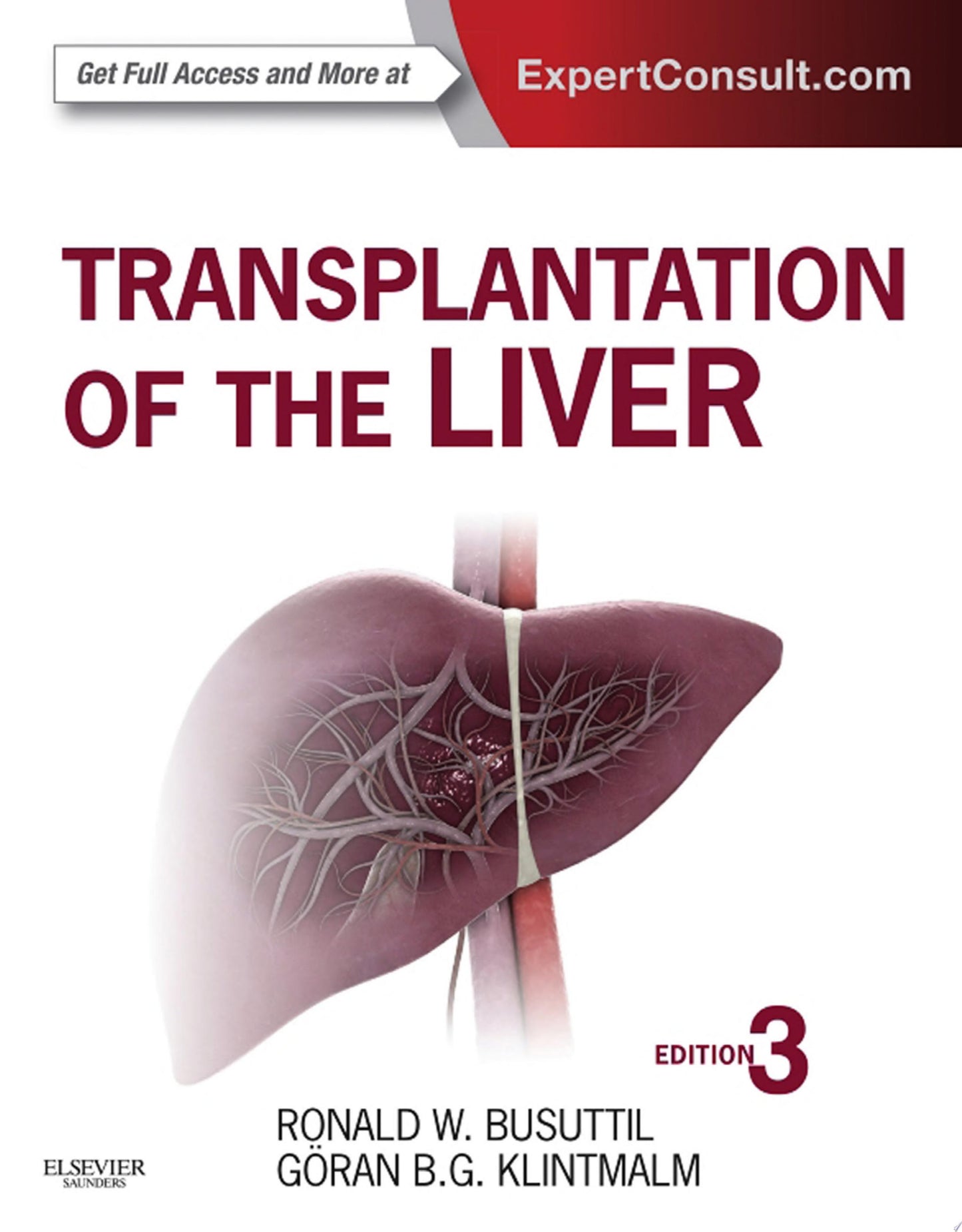 Transplantation of the Liver, 3rd Edition