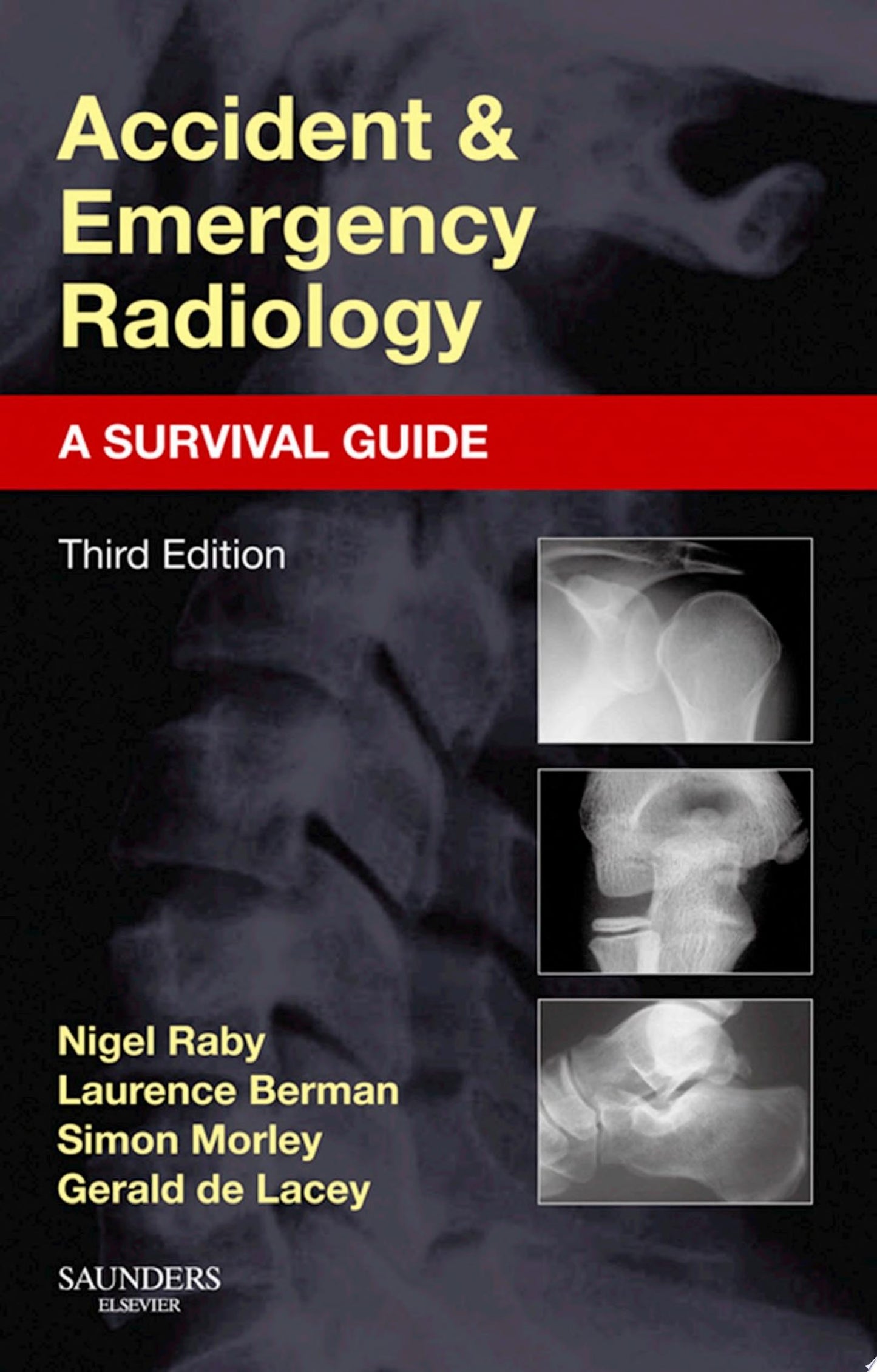 Accident and Emergency Radiology: A Survival Guide, 3e