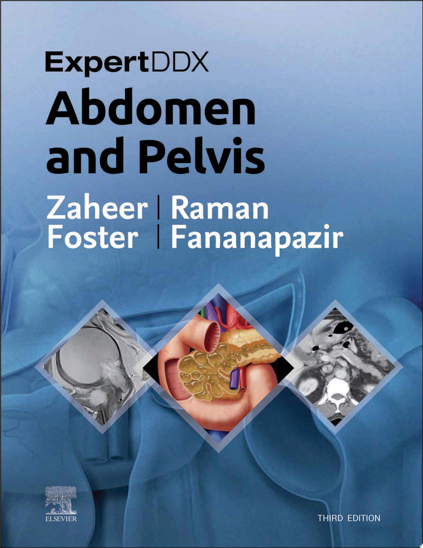 ExpertDDx: Abdomen and Pelvis, 3rd Edition
